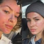 La China Suárez se hizo un retoque estético en Turquía y sorprendió a todos con cómo le quedó la cara